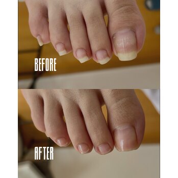 足の爪、伸びすぎてませんか?