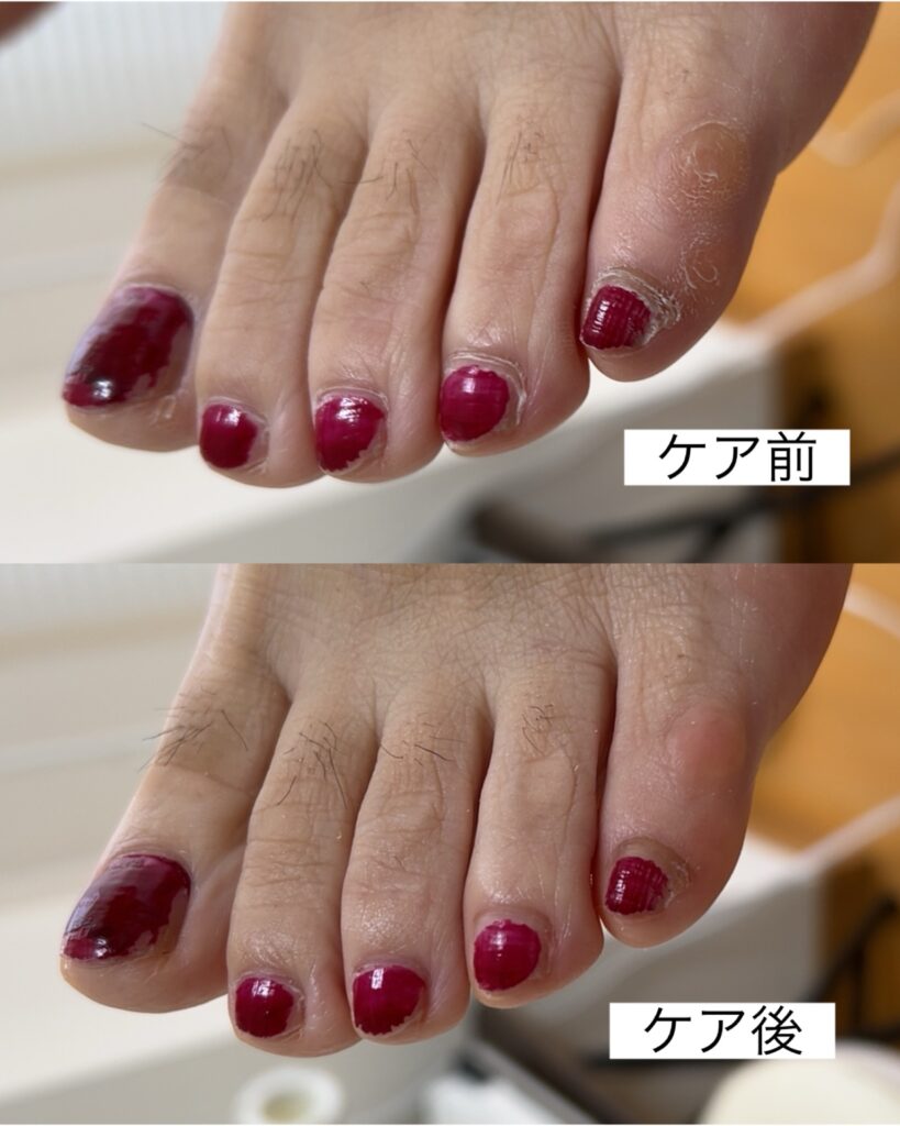 70代・女性