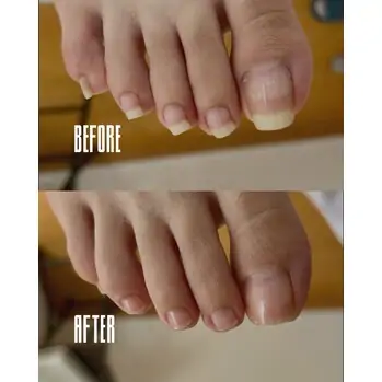 足の爪、伸びすぎてませんか?