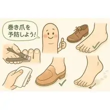 【足元から健康に】巻き爪を予防するための5つの習慣